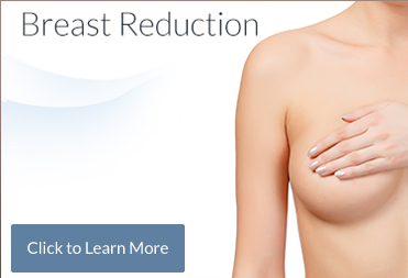 Breast Reduction